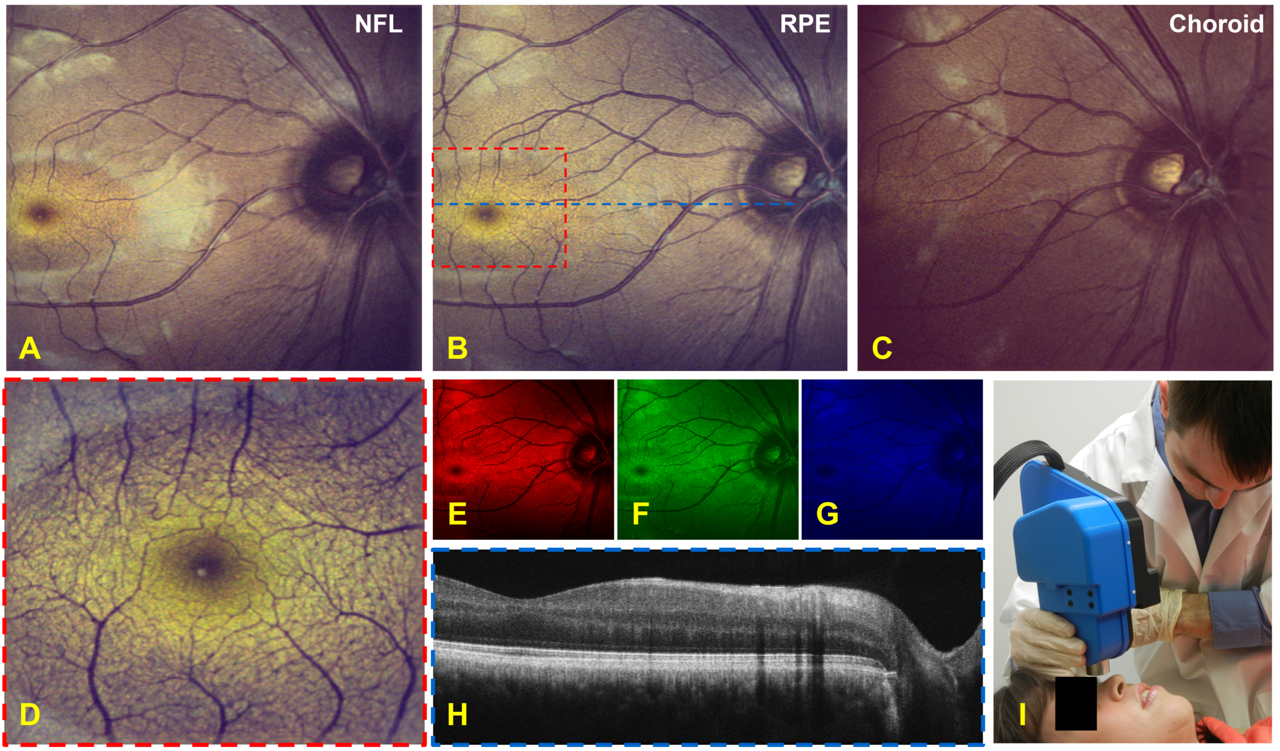 Retinal images captured by OCT